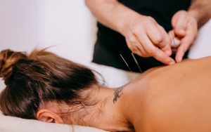 O poder da acupuntura e da fitoterapia chinesa